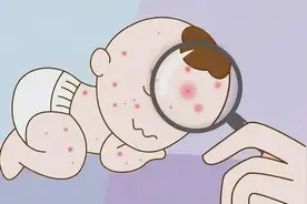 宝宝身上出现“红点点”，千万不要大意！图片