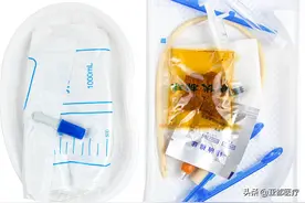 一次性使用无菌导尿包的操作流程-亚都医疗图片