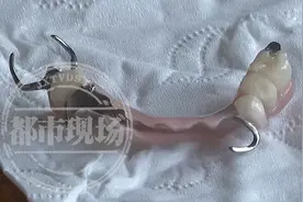 江西南昌：女子两次种牙，结果同一医生两次都打错植体位置？图片