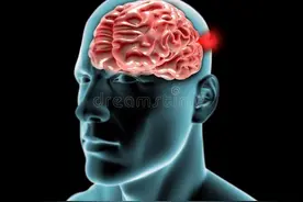 脑供血不足会引发脑梗！身上4个异常已提前发出信号，你却没在意图片