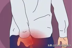 克罗恩病所致的肛周表现有哪些？怎么处理？图片