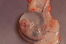 女人最多能承受几次流产？超过这些次数对身体伤害很大，别不重视图片