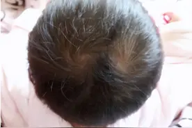 孩子头上的“旋”代表什么？与智商和性格有关吗？今天告诉你答案图片