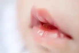 「口腔科普」宝宝口腔出现小白点，不一定是奶块，很可能是这种病图片