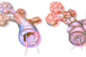 支气管哮喘治疗年度进展2022图片