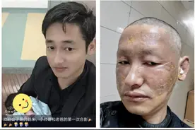 全网心疼的对比照，更新了！图片