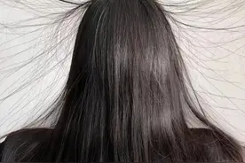静电、毛衣起球、羽绒服脏了！冬日的小烦恼，试试这些小妙招图片