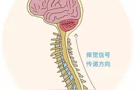 “痒痒肉”是块啥肉？为啥自己挠没反应，被别人一挠就笑呢？图片