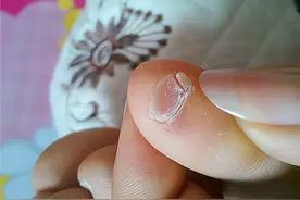 小脚趾指甲分成两瓣的人，究竟是什么来历？你的指甲也这样吗？图片