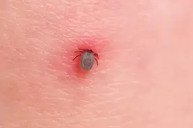 蜱虫俗称草爬子，毒性很大，千万小心。图片