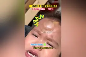 1岁宝宝摔倒头磕大包暴风哭泣，医生：这样处理，避免二次伤害图片