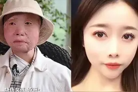 “折翼天使”乔燕，24岁被毁容、截肢，负债80多万仍捐款500元图片