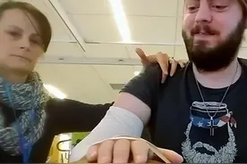 不得不承认美国医术很强：双手被炸断了6年，竟移植他人手臂复活图片