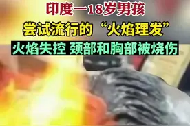 印度18岁男子尝试“火焰理发”被烧伤图片