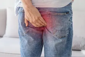 外痔疮的治疗方法有哪些图片