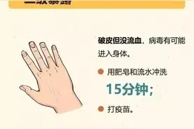 【疫苗接种科普宣传】狂犬疫苗——你想要知道的这里都有图片