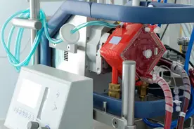 光开机就要5万，人工肺ECMO为何这么贵？图片