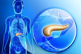 被称为“癌中之王”的胰腺癌，早期的症状有哪些？图片
