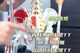第三集：一旦出现骶髂关节的问题，极度推荐这个动作，快去...图片
