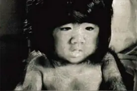 中国第一毛孩于震寰：曾因外表异于常人火遍全国，如今已娶妻生子图片