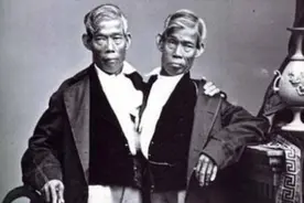 连体人如何结婚生子？连体兄弟娶美国姐妹花，共生育出22个孩子图片