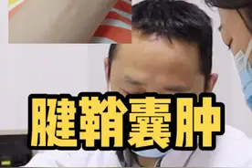 发现腱鞘囊肿可以及早去门诊就医，有些患者囊肿会自行消失，但有些时间久了之后处理会相对困难。#腱鞘囊肿 #骨科蔡俊丰 #手腕鼓包视频封面