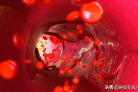 贝伐珠单抗的那些事图片