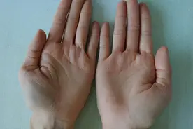 一位梅毒患者的治疗经历图片