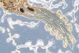 含有“寄生虫”的四种食物，尽量少吃，早知早好图片