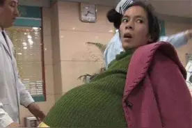 广东女子怀孕挺55公斤巨肚，12个月未见生产，医生直言看不见胎儿图片