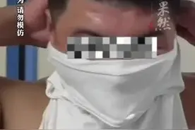 男子吞灯泡后卡在嘴里 求助消防后被送往医院 医生用扩张钳成功取出图片