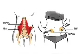 臀部前面疼，后面疼，侧面疼，都是什么问题？医生来告诉你图片
