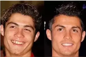 世界杯球星也爱美？内马尔、C罗整容前后判若两人图片