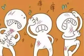 荨麻疹是免疫力低下惹得祸？这4种行为会引发病情反复，别再做了图片