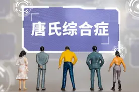 唐氏综合征是什么病图片