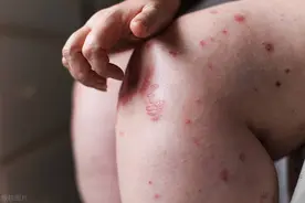 小便后，到底能不能用纸擦？医生提醒：有人一直做错了图片