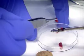 人类为何不敢同类相食？一旦染上致死率100%，揭露人类基因的秘密图片