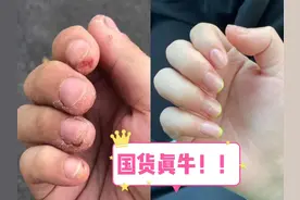 手脚干裂疼痒别拖了！这几个国货皲裂膏，随便抹抹干裂就好了图片