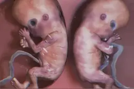 双胞胎是怎么来的？探索双胞胎形成背后的神秘过程图片