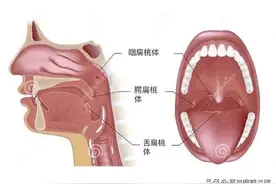 家长须知：孩子腺样体肥大和扁桃体肥大同时有，怎么办？图片