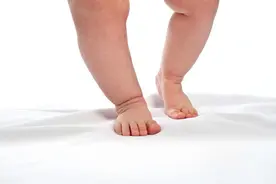 O型腿，X型腿，怎么办？图片