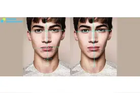 面部歪斜的幕后元凶—颞下颌关节紊乱图片