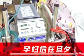 盘州孕妇危在旦夕！贵医ECMO团队带着“家伙”夜奔600公里去救命图片