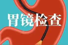 普通胃镜和肠镜亲测感受图片