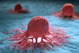 人类为何至今无法攻克癌症？医生：3个原因很现实，谈治愈不易图片