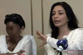 被泼硫酸后该怎么自救？图片