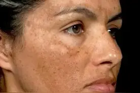 快速美白淡斑祛斑的护肤品都是骗人的，不要再上当了图片