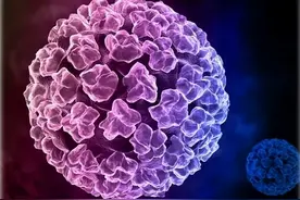 皮肤上的“小瘊子”越来越多该如何祛除呢？图片