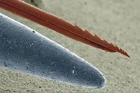 针尖上的细菌，21张电子显微镜下的视图图片