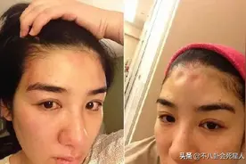 流产、脑震荡、鼻青脸肿伤痕累累，这些被家暴的女星一个比一个惨图片